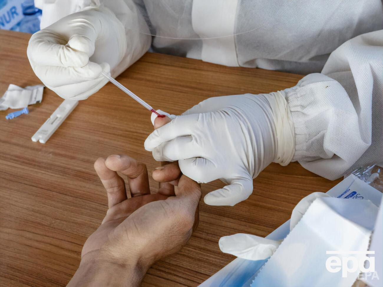 У Львівській області впродовж доби було виявлено 153 нові випадки інфікування