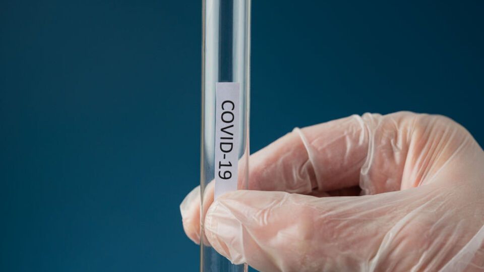 За сутки в Украине от COVID-19 умерли 23 человека