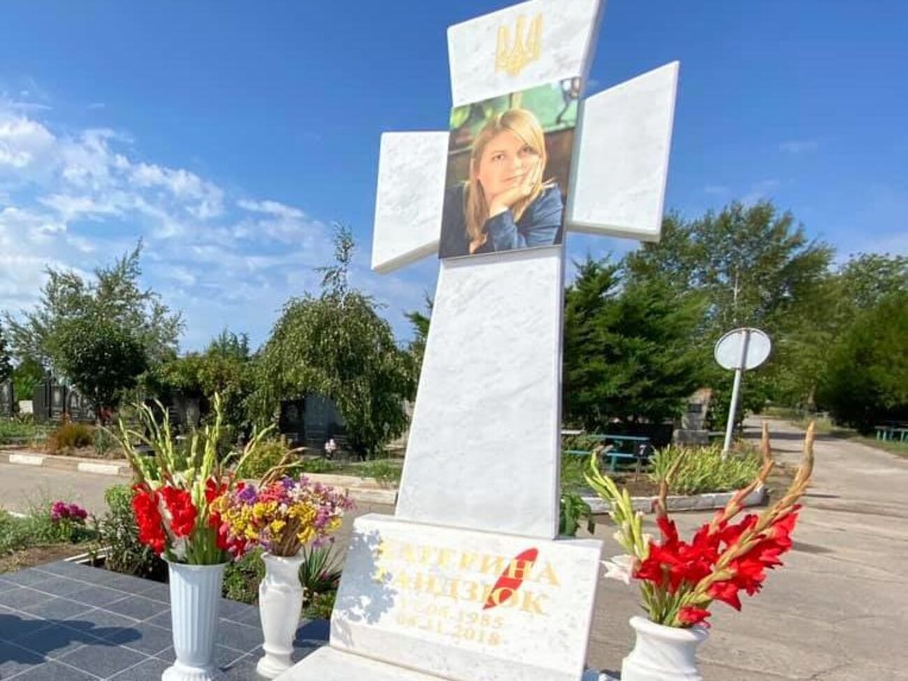 Гандзюк умерла от последствий кислотных ожогов