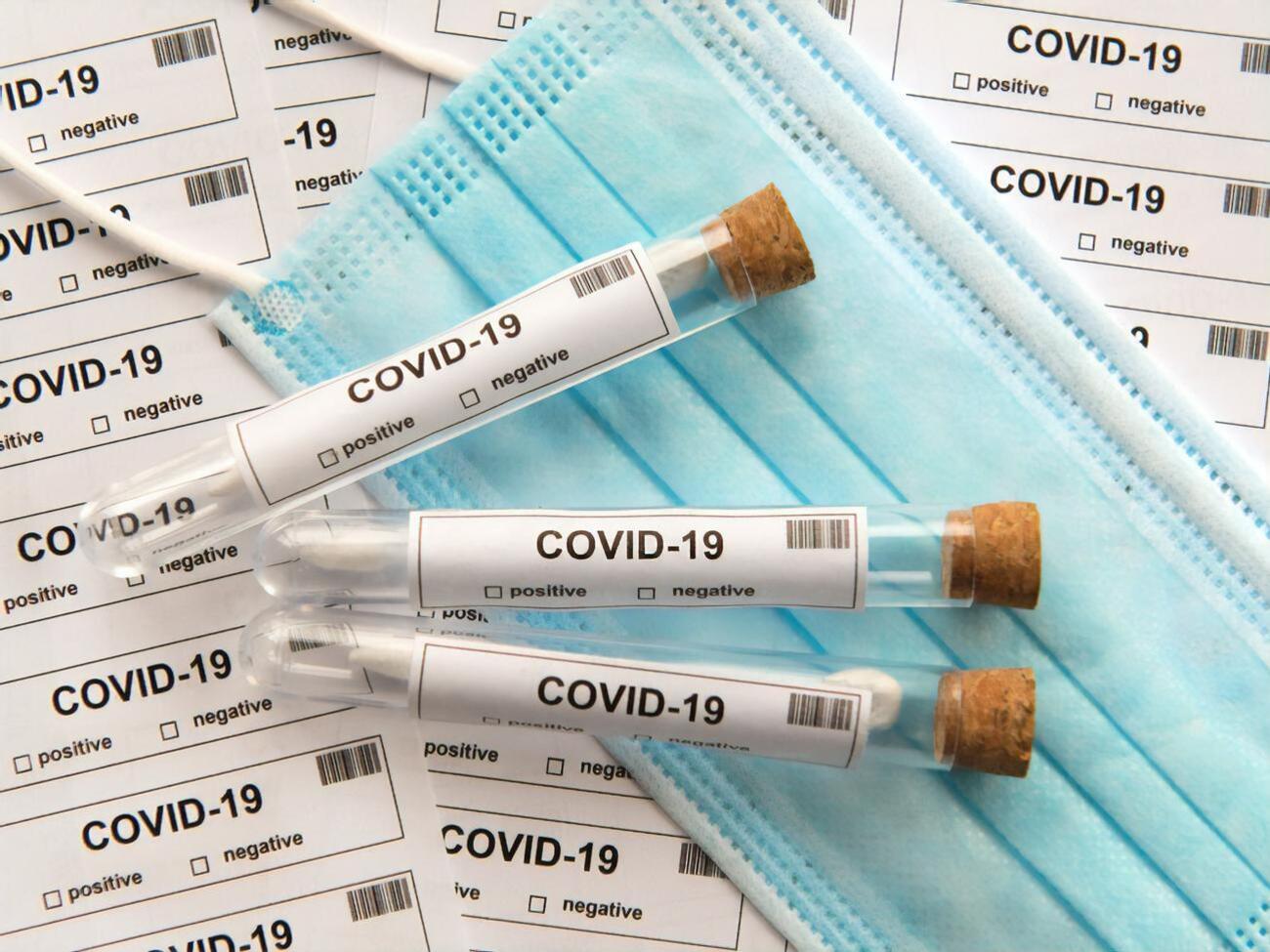 Протягом останньої доби з COVID-19 було госпіталізовано 215 осіб