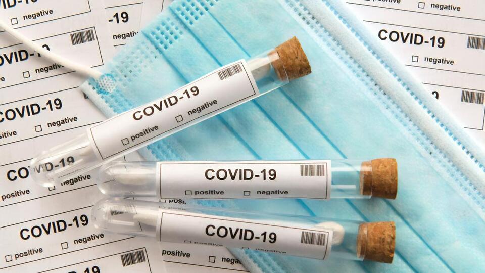 Протягом останньої доби з COVID-19 було госпіталізовано 215 осіб