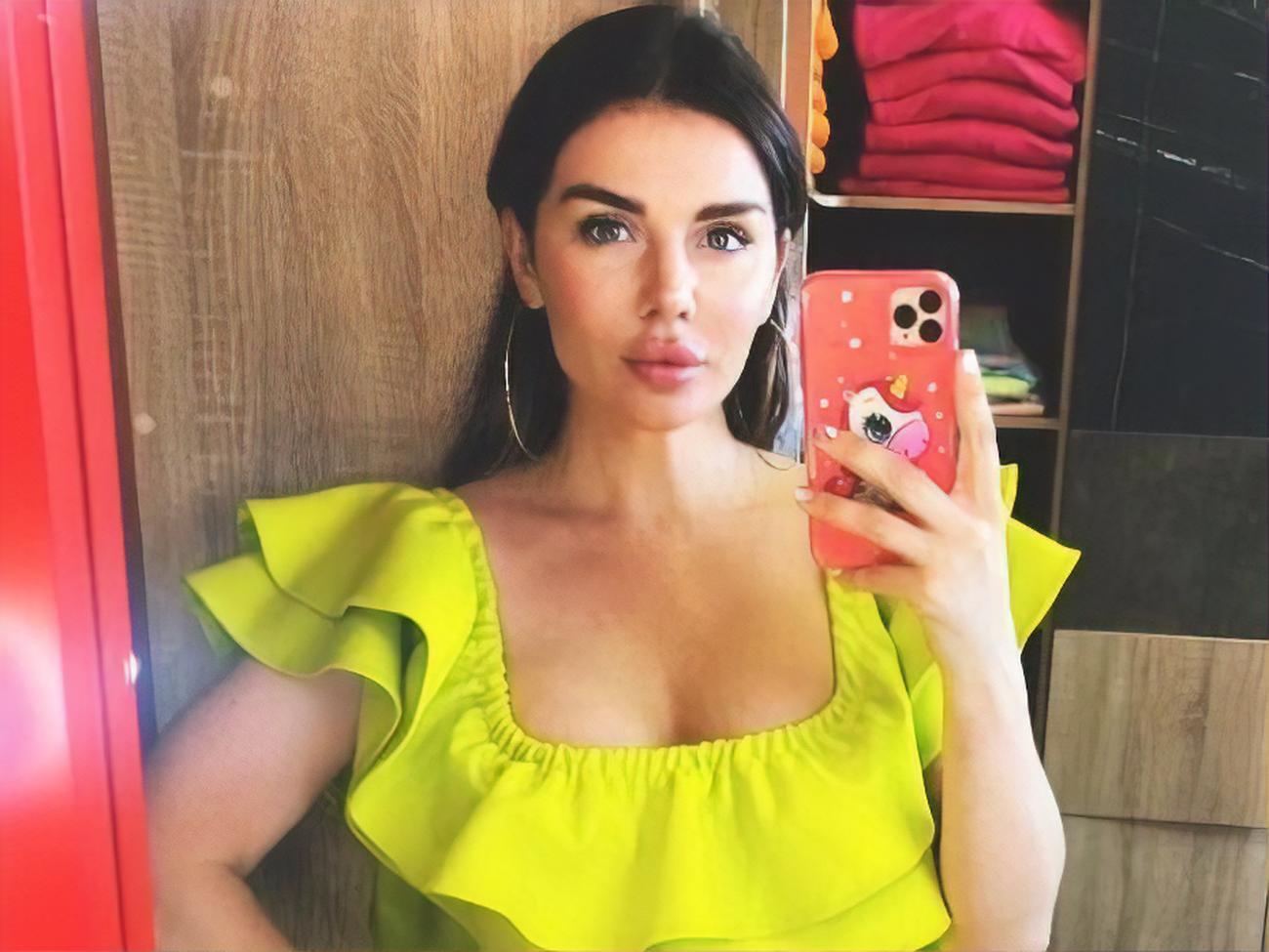 Сєдокова: У 21 рік я зробила ліпосакцію