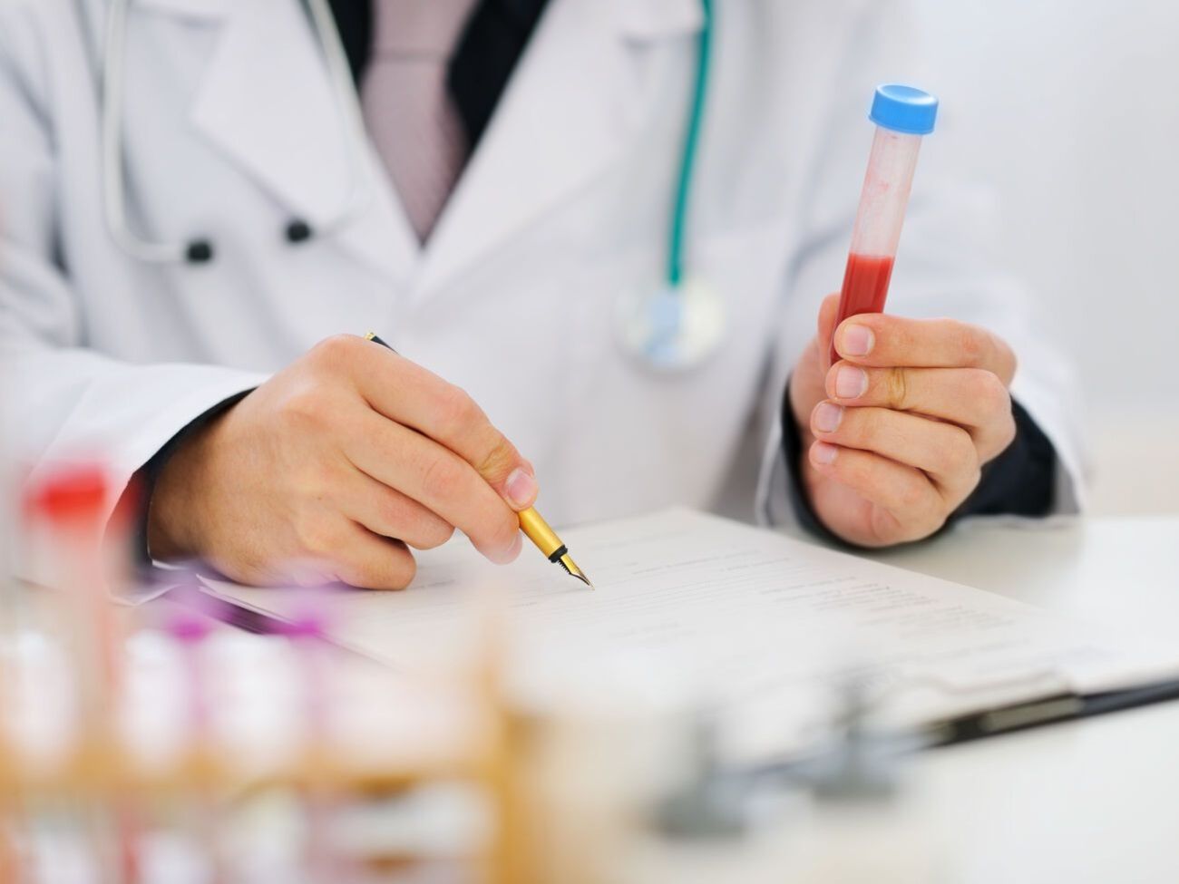 В Донецкой и Черниговской областях было проведено недостаточно лабораторных тестов на COVID-19