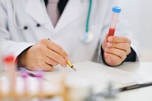 В Донецкой и Черниговской областях было проведено недостаточно лабораторных тестов на COVID-19