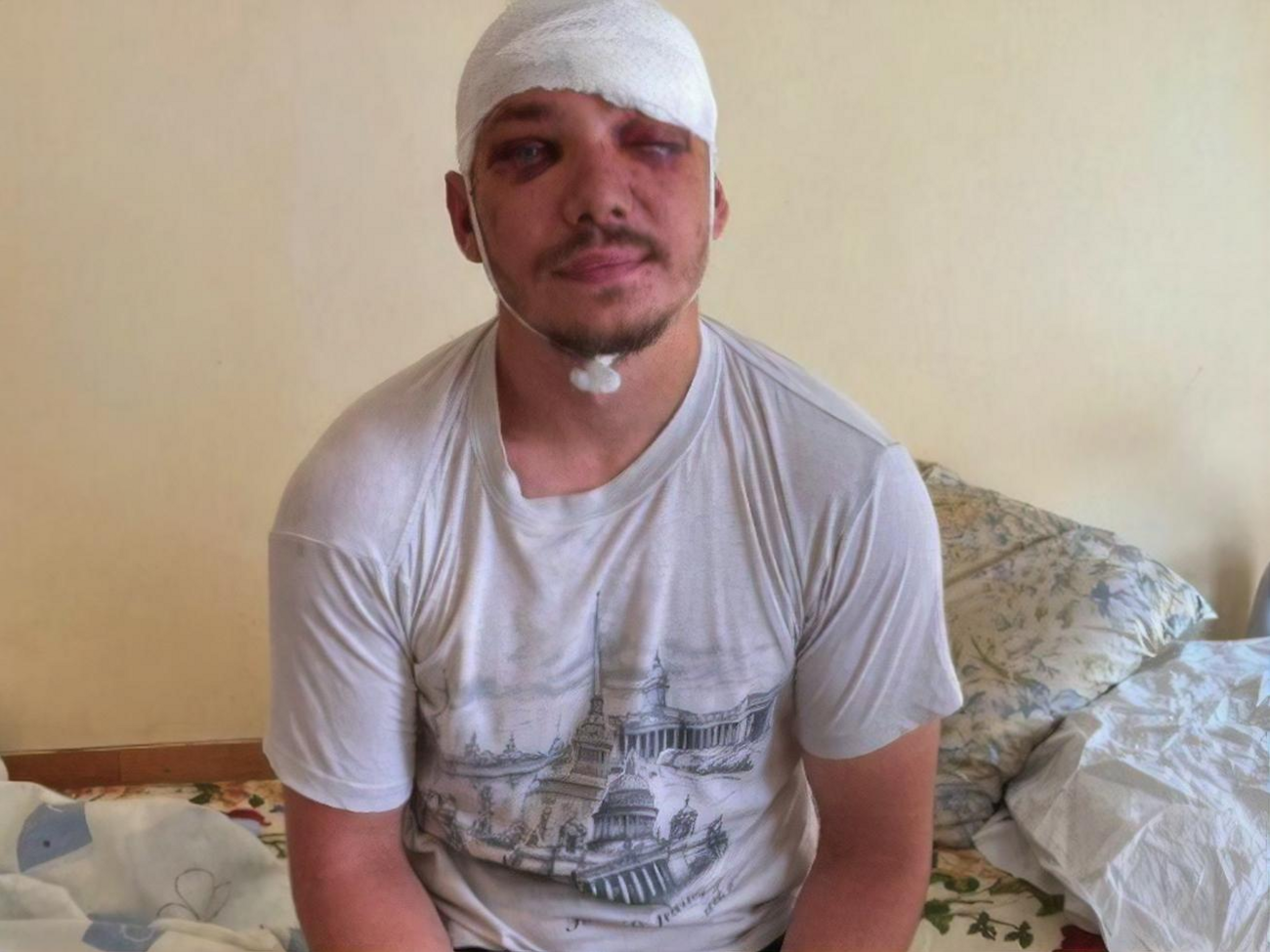 Роженко&nbsp;попал в больницу с черепно-мозговой травмой, сотрясением головного мозга, ушибом и ранами мягких тканей лица и головы