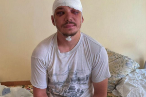 Роженко попал в больницу с черепно-мозговой травмой, сотрясением головного мозга, ушибом и ранами мягких тканей лица и головы