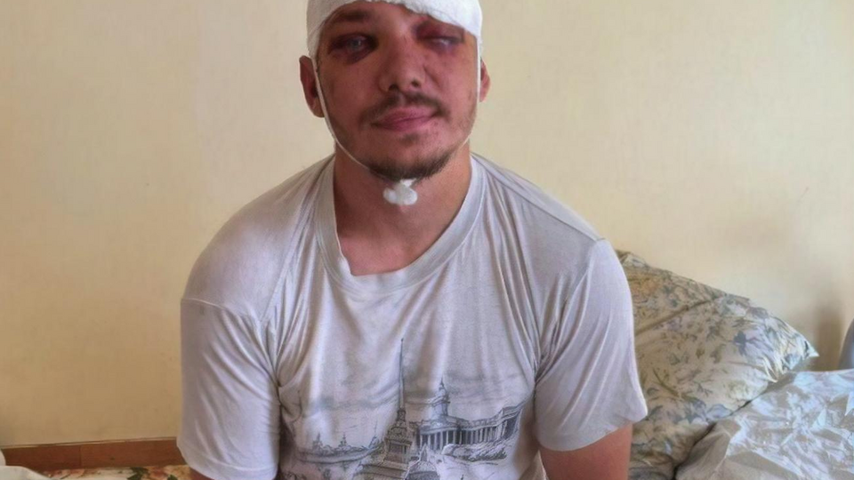 Роженко попал в больницу с черепно-мозговой травмой, сотрясением головного мозга, ушибом и ранами мягких тканей лица и головы