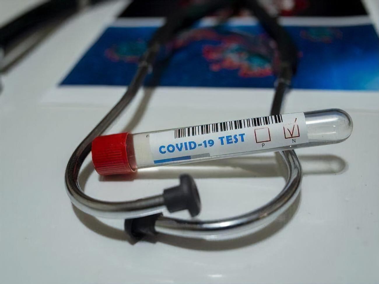 В Донецкой и Черниговской областях проведено недостаточно лабораторных тестов на COVID-19