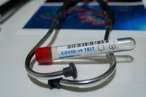 В Донецкой и Черниговской областях проведено недостаточно лабораторных тестов на COVID-19