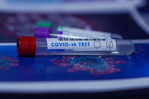 Лабораторный центр провел 438 тестов