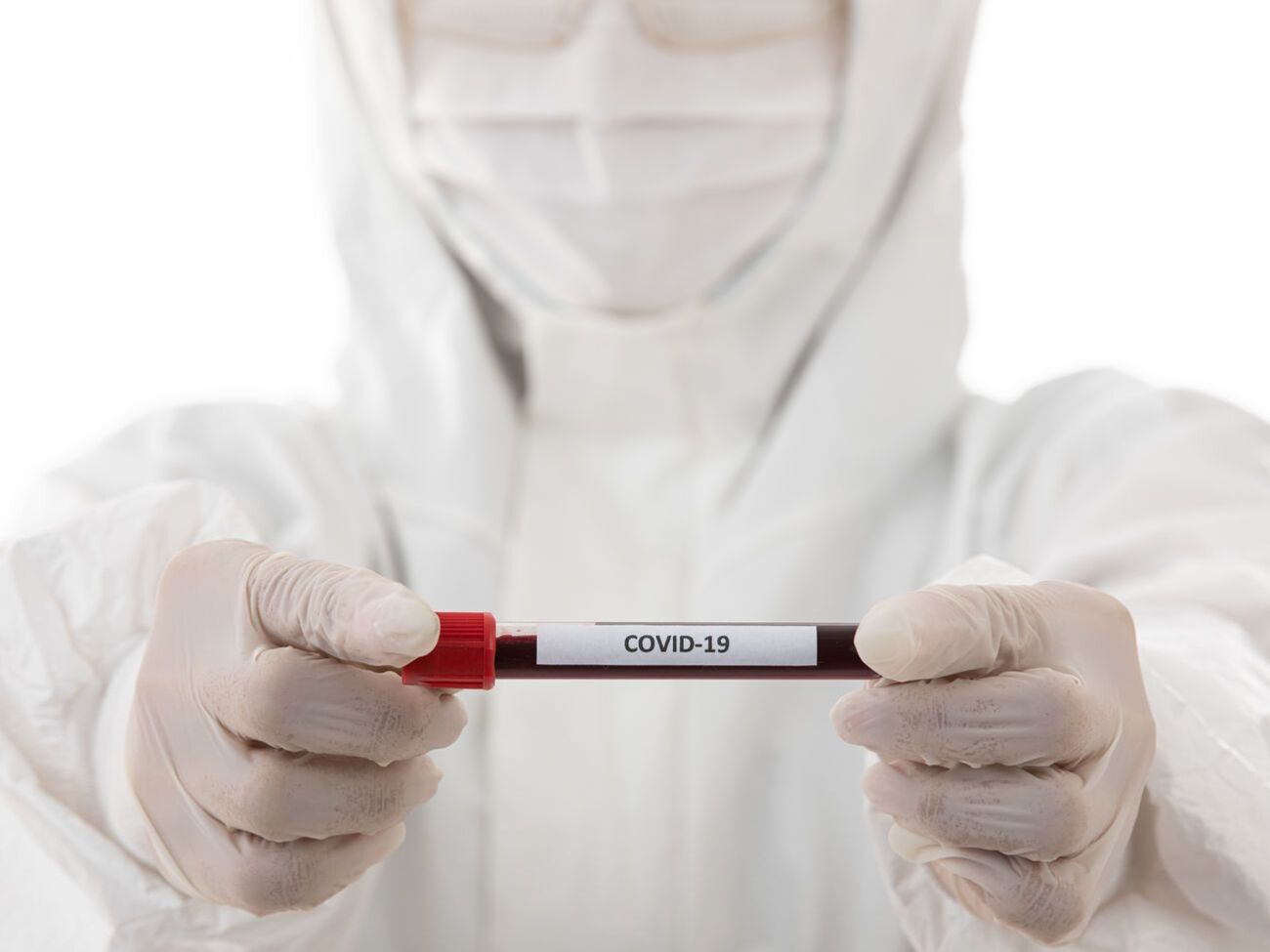 В Черновицкой области растет число новых случаев COVID-19