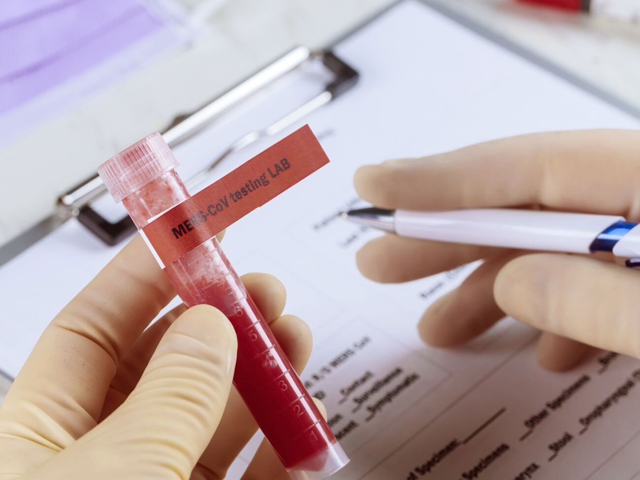 Протягом минулої доби коронавірусну інфекцію в Україні підтвердили у 1008 осіб