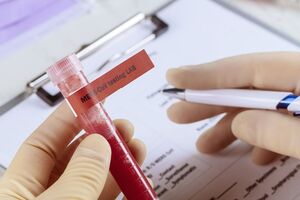 Протягом минулої доби коронавірусну інфекцію в Україні підтвердили у 1008 осіб