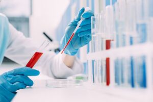 Загальна кількість інфікованих у Чернівецькій області з початку епідемії становить 7110 осіб