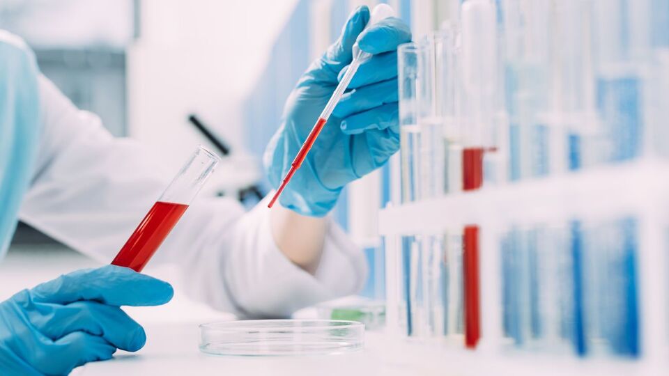 Общее количество инфицированных в Черновицкой области с начала эпидемии составляет 7110 человек