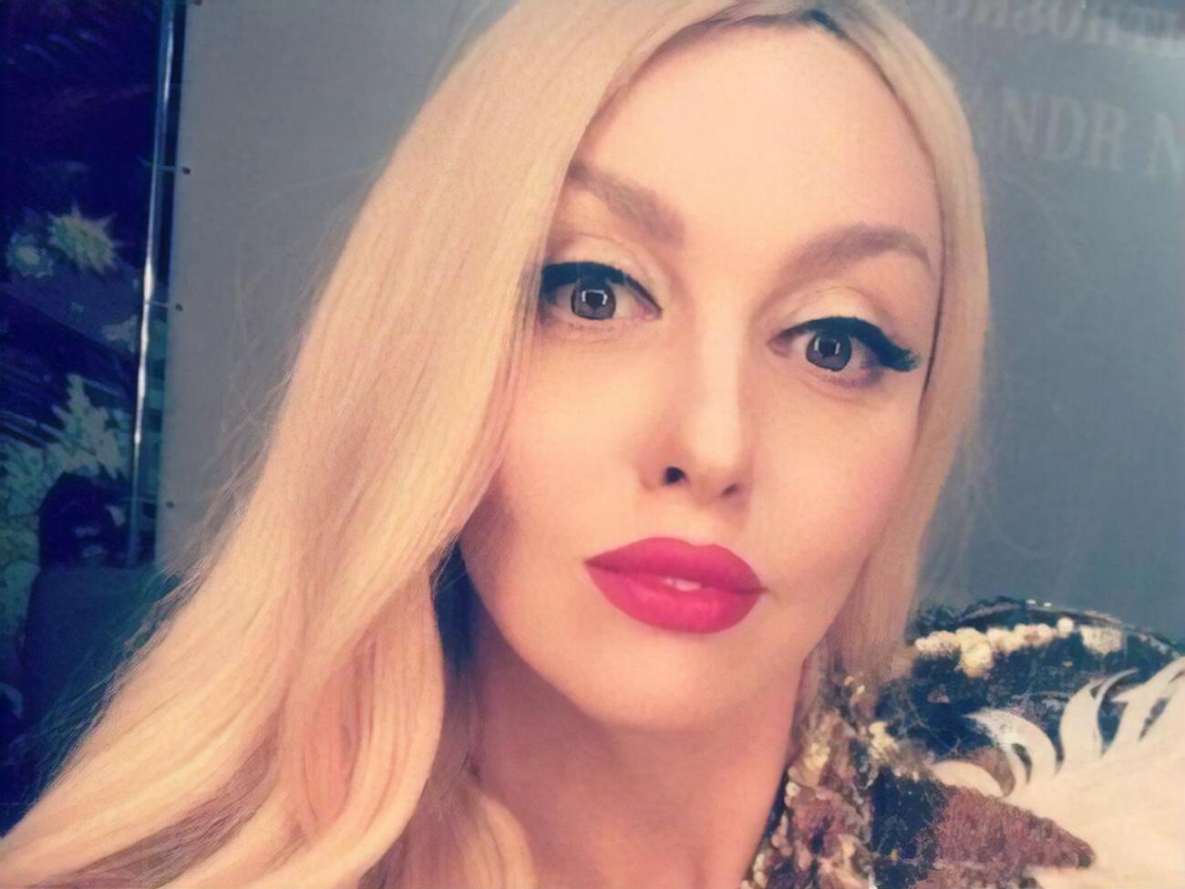 Полякова про маніпуляції з обличчям: Я хочу розповісти людям, що це таке