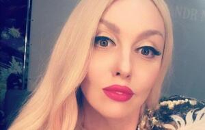 Полякова про маніпуляції з обличчям: Я хочу розповісти людям, що це таке