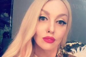 Полякова о манипуляциях с лицом: Я хочу рассказать людям, что это такое