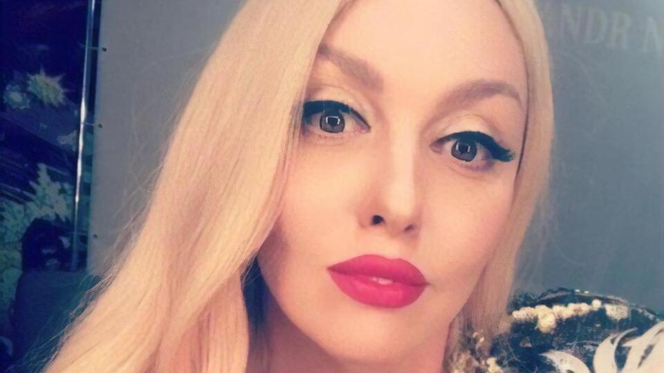 Полякова про маніпуляції з обличчям: Я хочу розповісти людям, що це таке