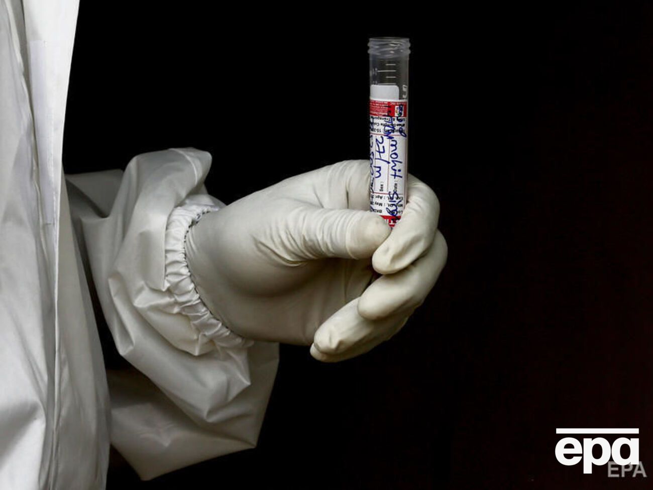 Украинские ученые, возможно, нашли объяснение, почему одни люди переносят коронавирусную инфекцию в легкой форме, а другие &ndash; в тяжелой