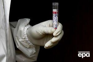 Українські вчені, можливо, знайшли пояснення, чому одні люди хворіють на коронавірусну інфекцію в легкій формі, а інші – у важкій