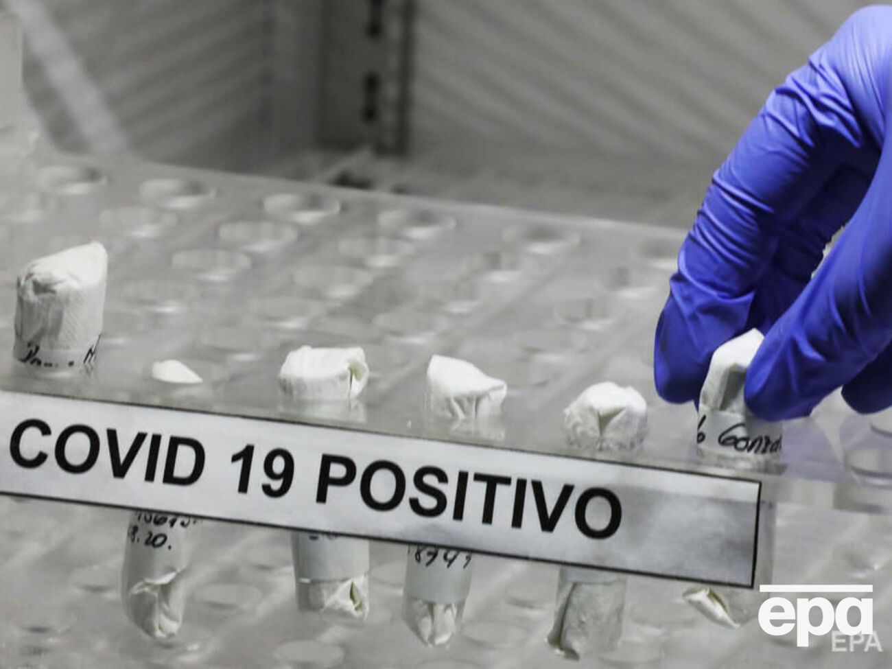 По-прежнему остается неясным, как часто происходит повторное заражение коронавирусом