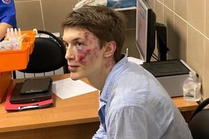 После обследования в больнице Жукова отпустили домой