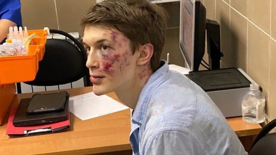 После обследования в больнице Жукова отпустили домой