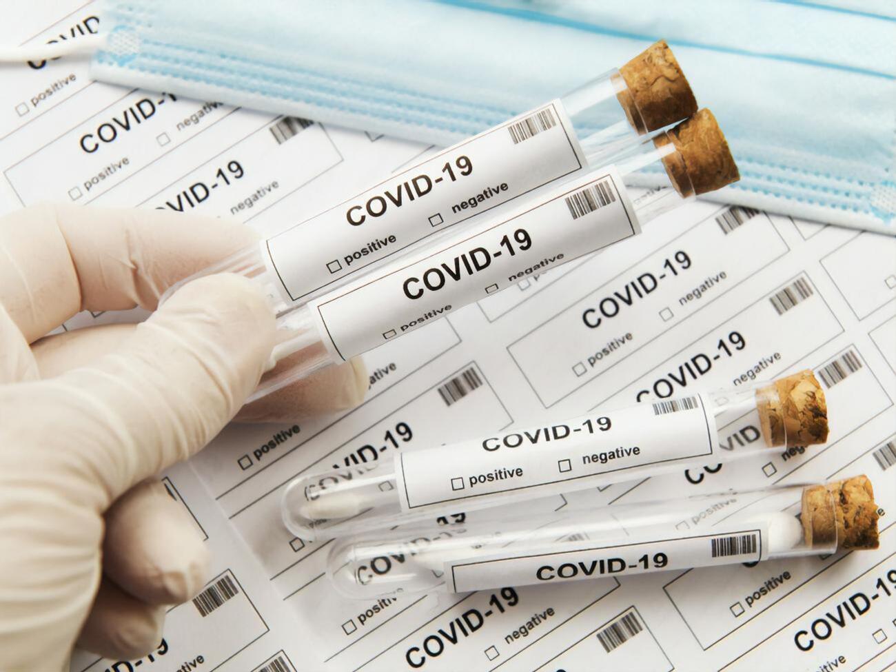 Показники проведених лабораторних тестів на COVID-19 відповідають нормам у всіх областях