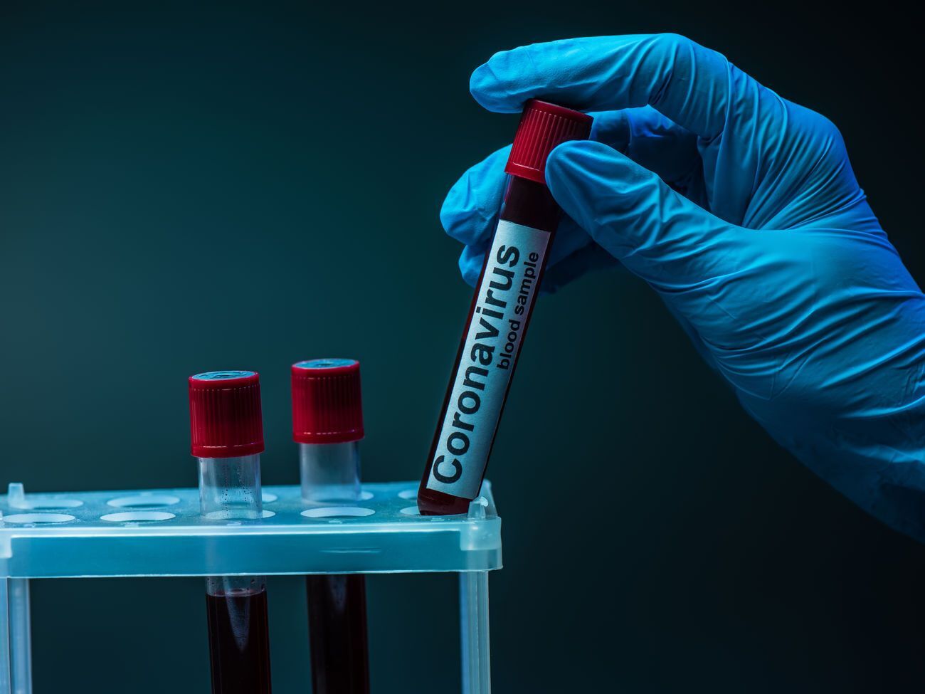 Днем ранее в ВСУ суточный прирост количества больных&nbsp;составил 34 человека, а&nbsp;сутки до этого &ndash; 31