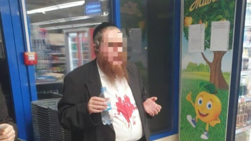 Пострадал израильтянин с видом на жительство в Украине