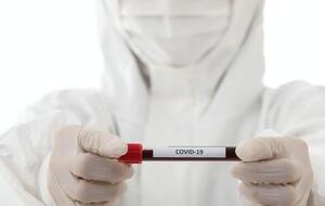 Лідером за масштабом поширення коронавірусу є США