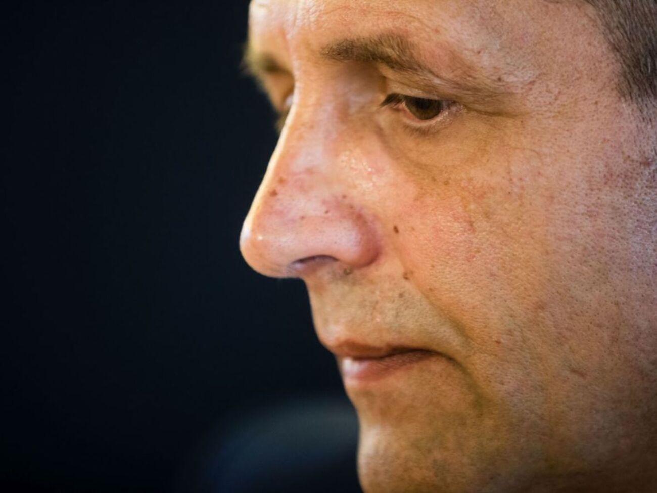 Лікарі ввели Балуха у стан медикаментозного сну через травму голови