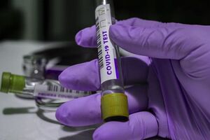 В Украине за сутки сделали более 45 тыс. тестирований