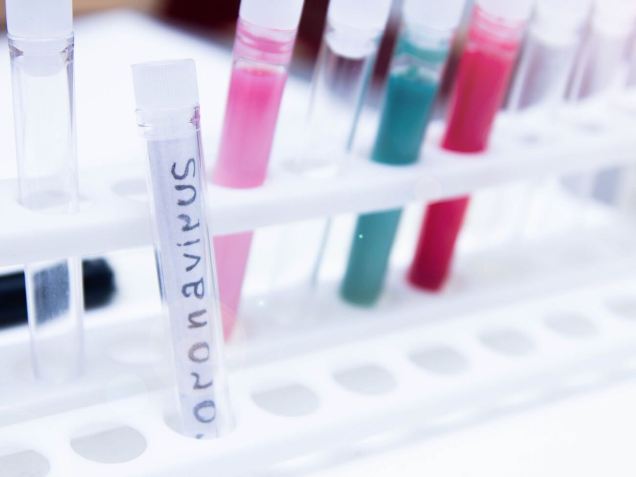 Якщо лікар вбачає таку необхідність, то біологічні матеріали у пацієнта відбирають медики мобільних бригад, зазначив Кличко