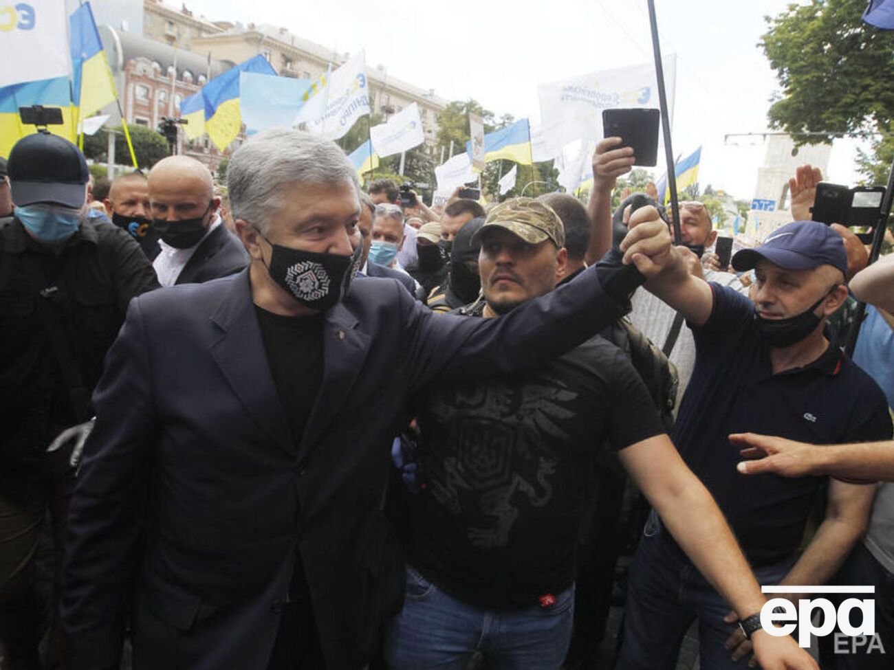 По словам экс-президента, он привык переносить болезни на ногах