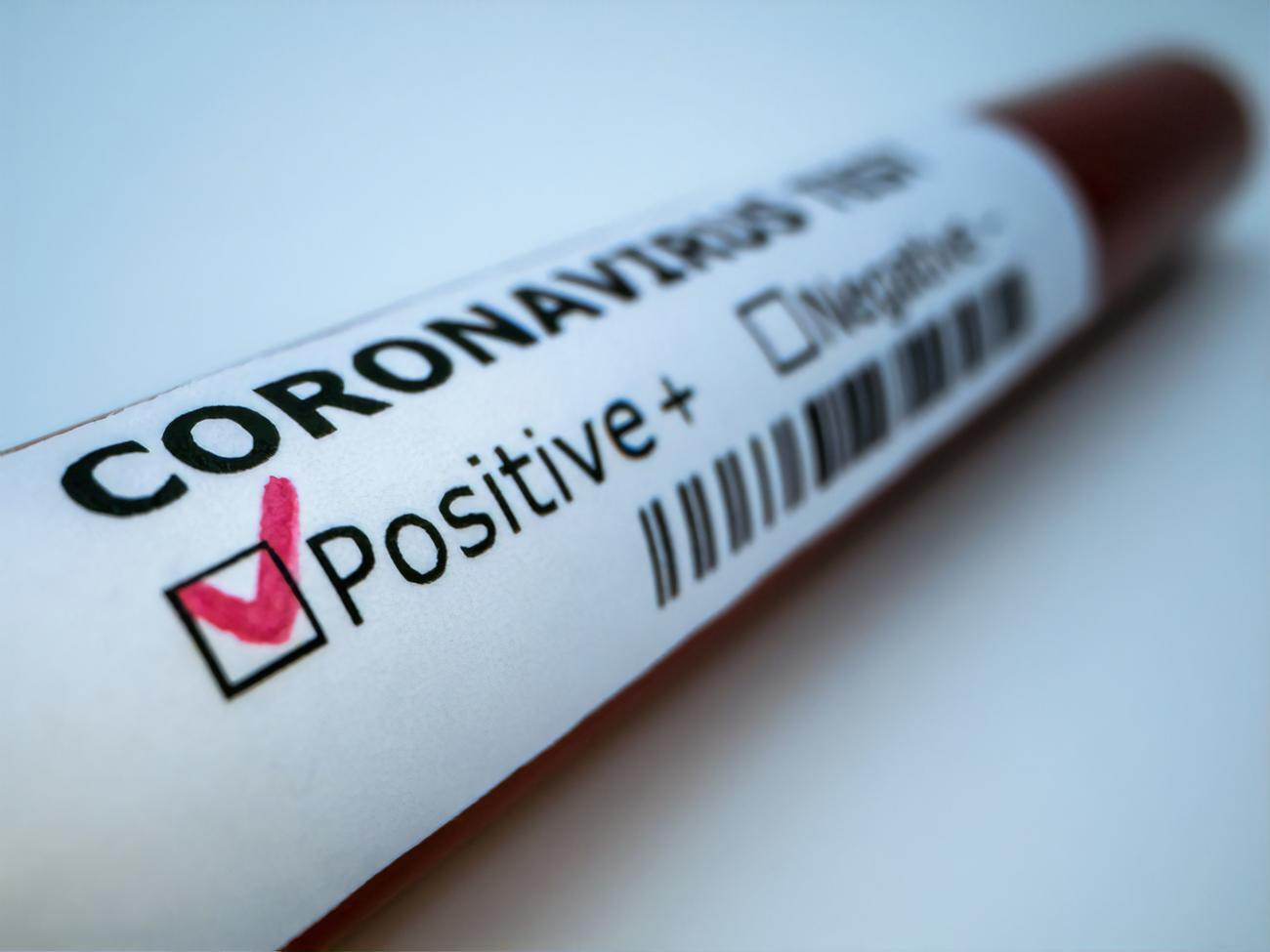 У Миколаївській області з початку пандемії 1665 підтверджених випадків захворювання