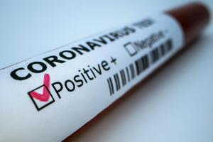 У Миколаївській області з початку пандемії 1665 підтверджених випадків захворювання