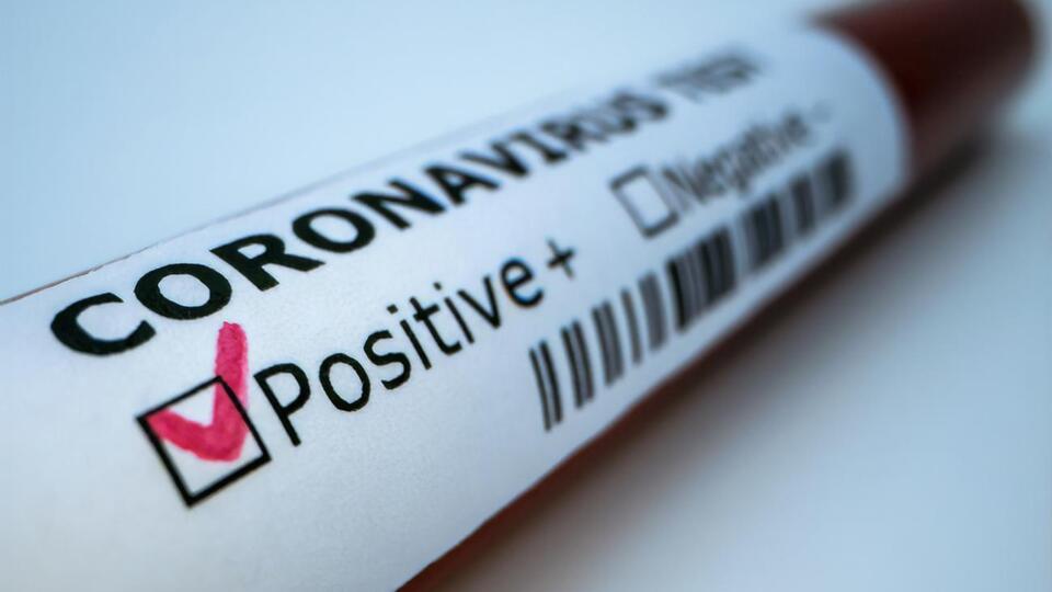 У Миколаївській області з початку пандемії 1665 підтверджених випадків захворювання