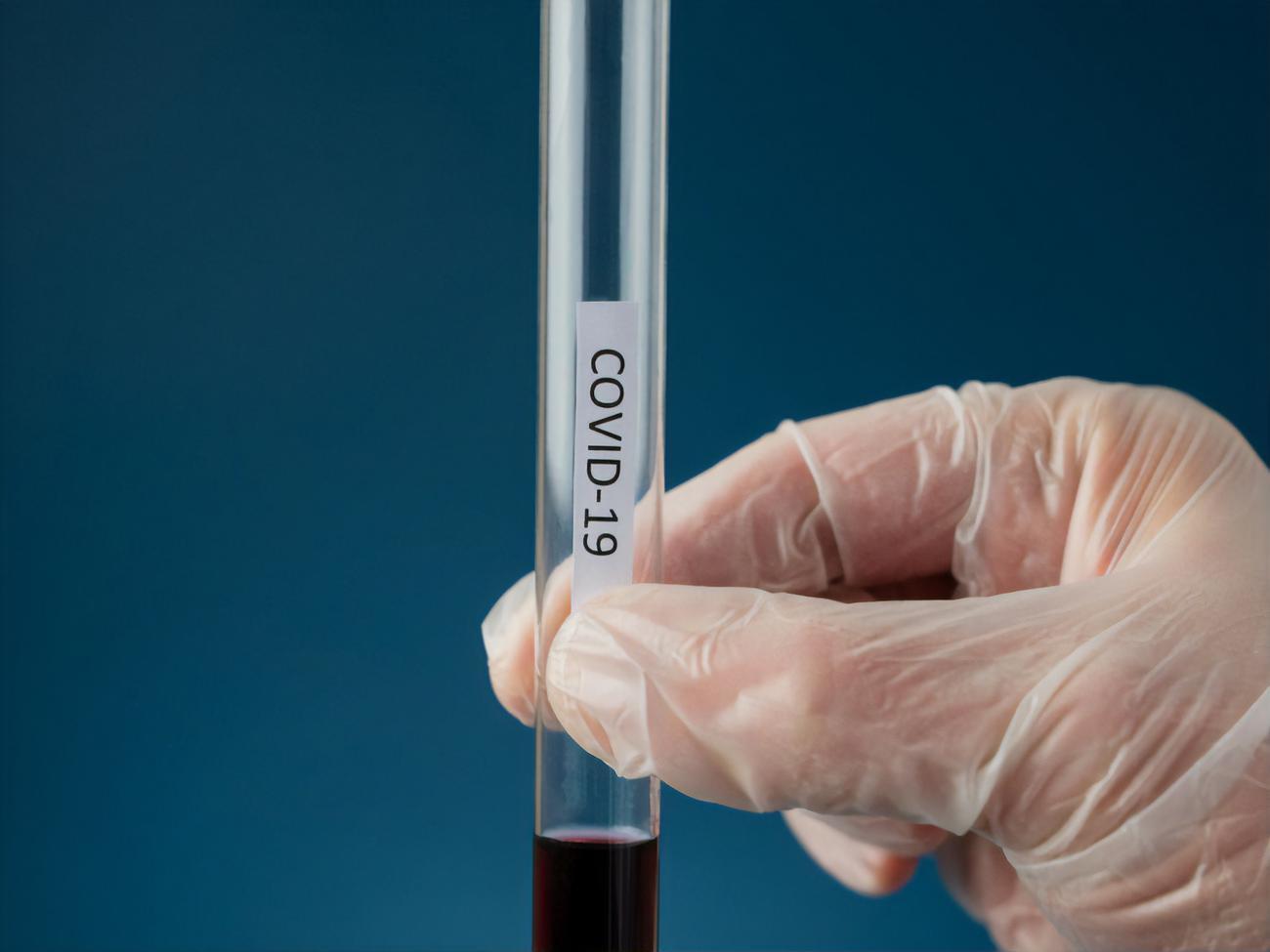 В Україні зареєстровано 135 894 випадки COVID-19