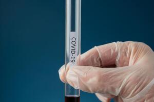 В Україні зареєстровано 135 894 випадки COVID-19