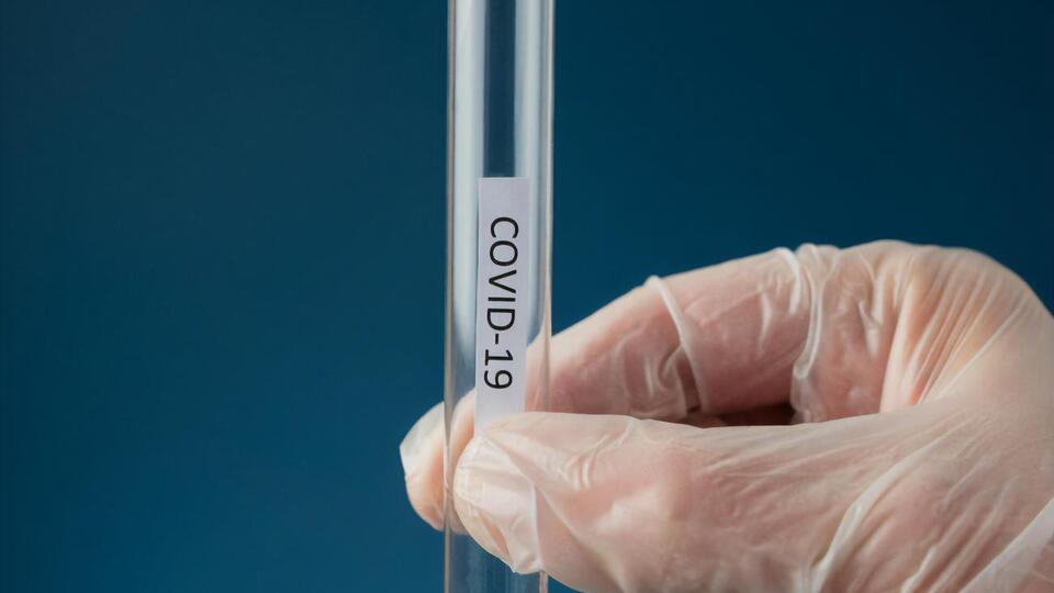 В Україні зареєстровано 135 894 випадки COVID-19