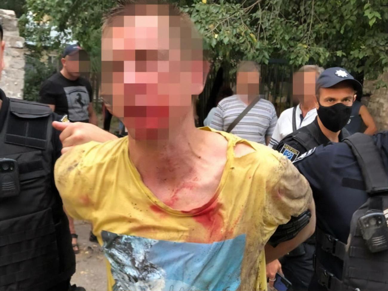 Бросившего гранату задержали