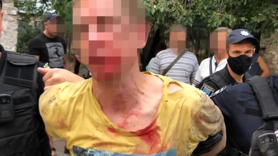 Бросившего гранату задержали
