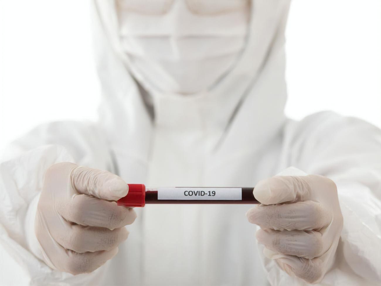 Німеччина входить до першого десятка країн за захворюваністю на COVID-19