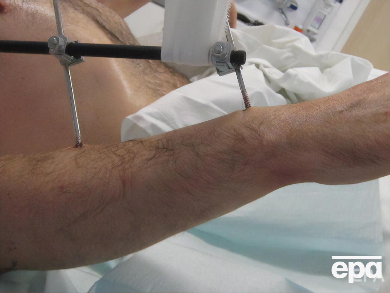 Пациентом был бывший электрик из Исландии