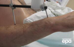 Пациентом был бывший электрик из Исландии