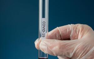 Наразі вважають, що спалах коронавірусної інфекції COVID-19 виник наприкінці 2019 року в китайському місті Ухань