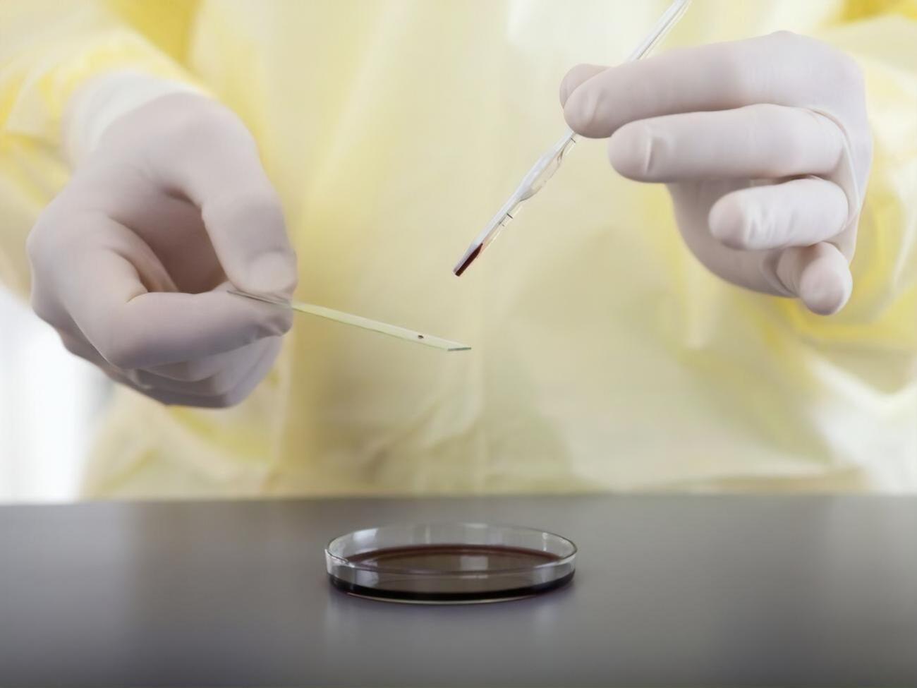 С 1901 года ученые обнаружили более 200 новых вирусов