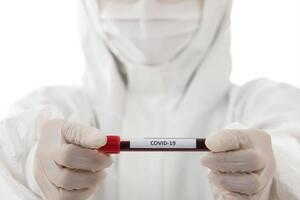 В Украине за сутки с коронавирусом госпитализировали 2567 человек